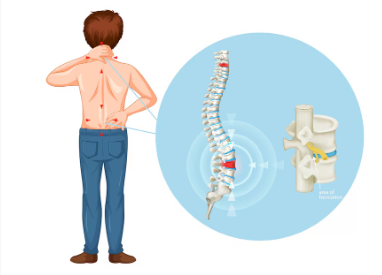 Best Pain Specialist in Indirapuram